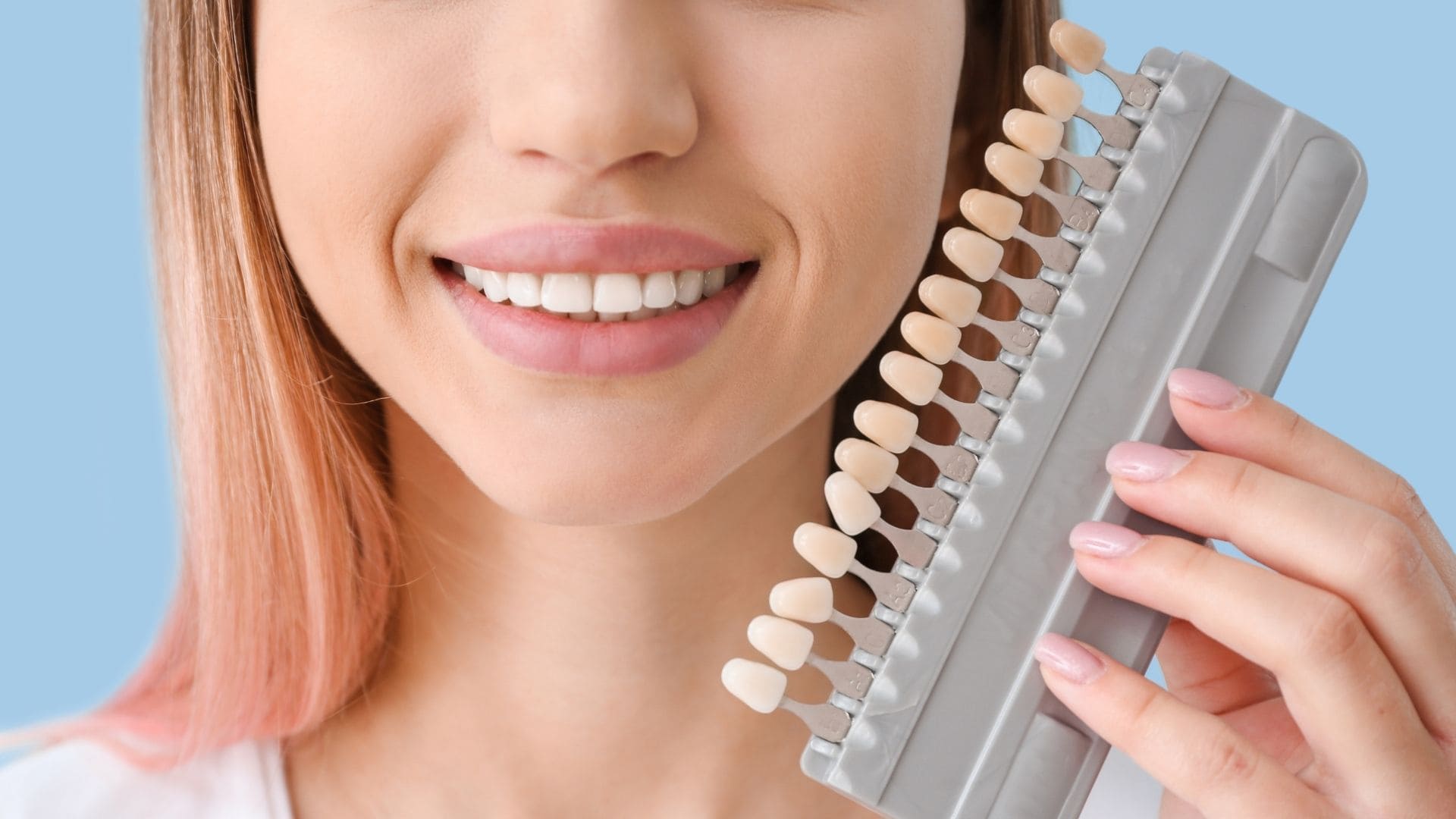 Dental Veneers in Noida