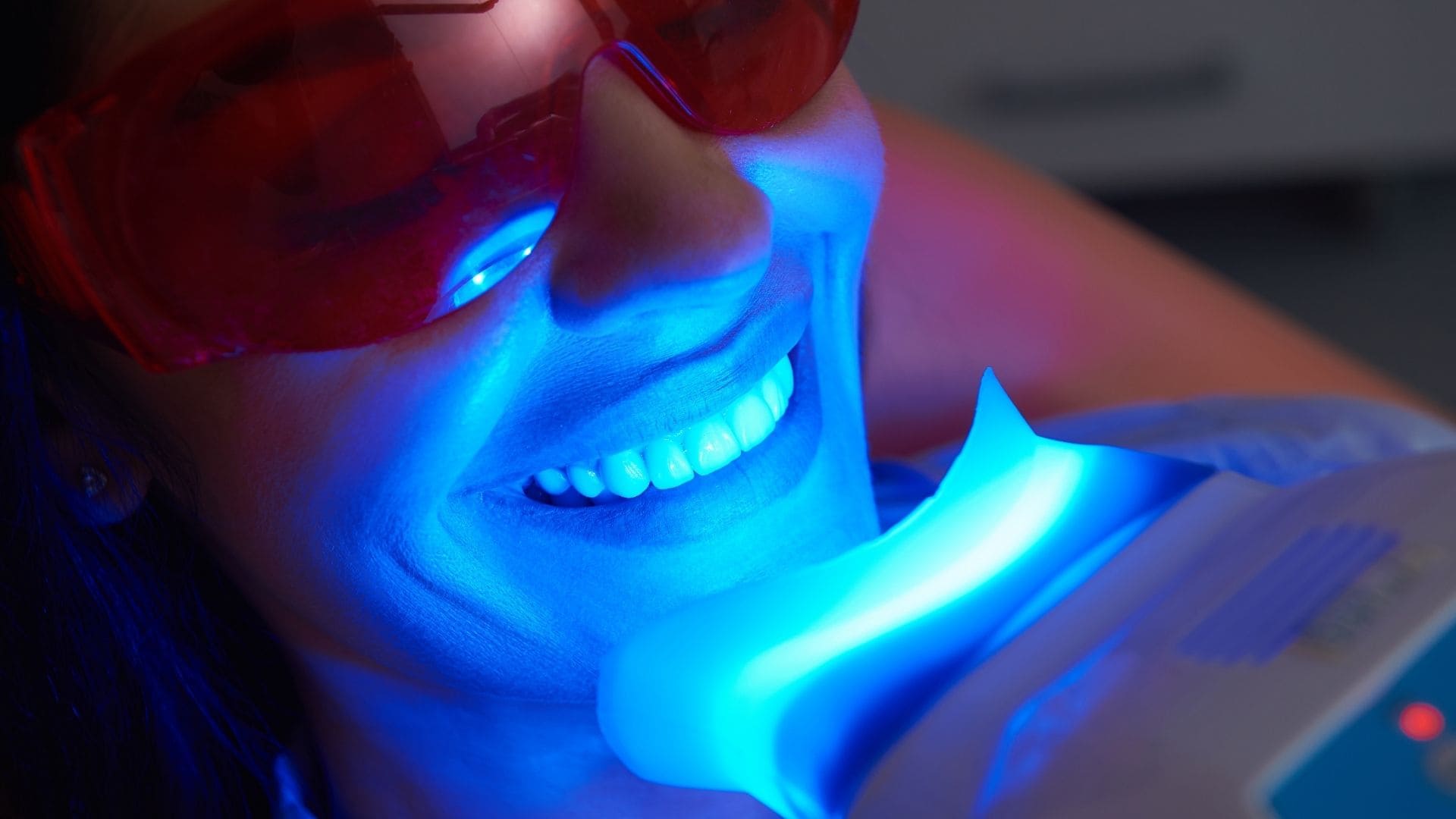 Teeth Whitening in Noida